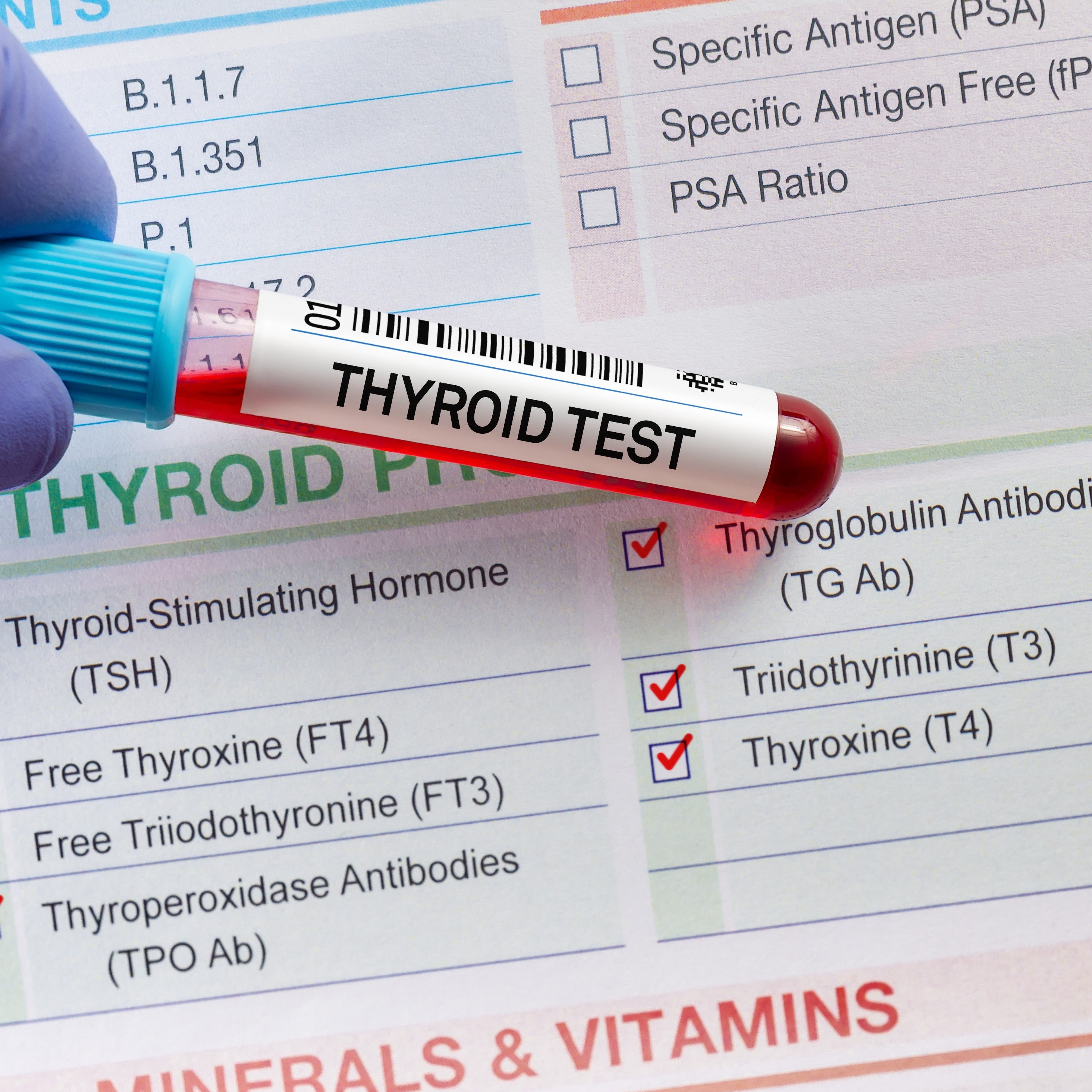 Taking Thyroid Medication but don't understand your Thyroid Lab Tests?