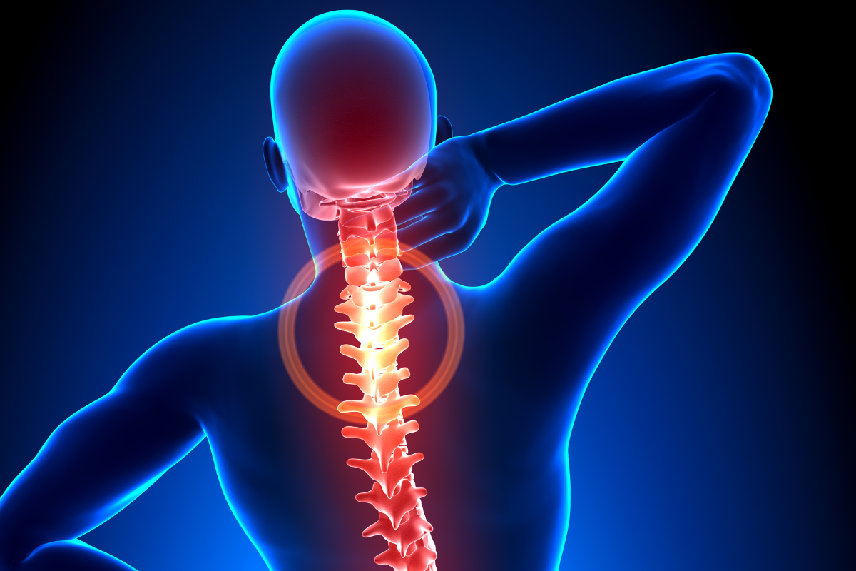 Osteoporosis in Women: Symptoms & Causes; How to Strengthen Your Bones in Midlife